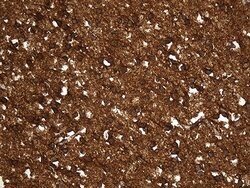 GDI1 Monoclonal Antibody (OTI8A3), TrueMAB , OriGene 100 &mu;L | Buy Online | OriGene | Fisher Scientific