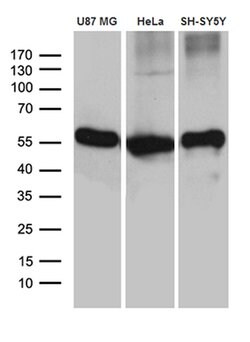 GDI1 Monoclonal Antibody (OTI1B1), TrueMAB , OriGene 100 &mu;L; Unconjugated:Antibodies,