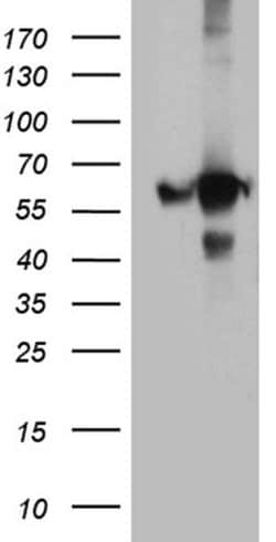 GDI1 Monoclonal Antibody (OTI7F7), TrueMAB , OriGene 100 &mu;L; Unconjugated:Antibodies,