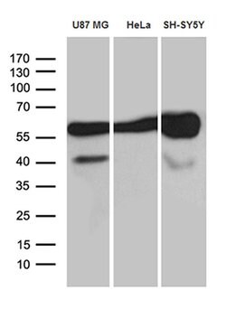 GDI1 Monoclonal Antibody (OTI7F7), TrueMAB , OriGene 100 &mu;L; Unconjugated:Antibodies,