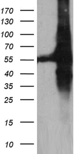 GDI1 Monoclonal Antibody (OTI8A3), TrueMAB , OriGene 100 &mu;L | Buy Online | OriGene | Fisher Scientific