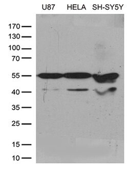 GDI1 Monoclonal Antibody (OTI8A3), TrueMAB , OriGene 100 &mu;L | Buy Online | OriGene | Fisher Scientific