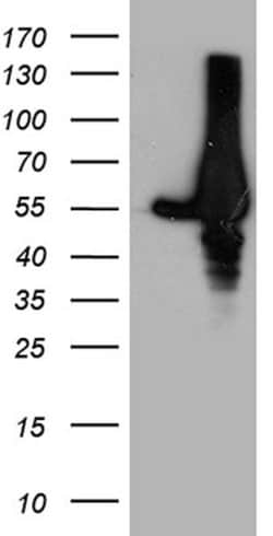 GDI1 Mouse anti-Human, Clone: OTI8B2, lyophilized, TrueMAB 100 &mu;g; Unconjugated:Antibodies,