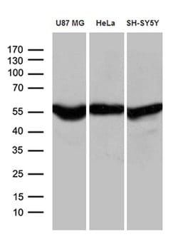 GDI1 Mouse anti-Human, Clone: OTI8B2, lyophilized, TrueMAB 100 &mu;g; Unconjugated:Antibodies,