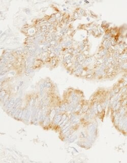 GEF-H1 Rabbit anti-Human, Polyclonal, Bethyl Laboratories 100 &mu;L; Unconjugated:Antibodies,