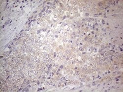 GEMIN2 Monoclonal Antibody (OTI4B3), TrueMAB , OriGene:Antibodies:Primary