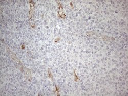 GEMIN2 Monoclonal Antibody (OTI4C11), TrueMAB , OriGene:Antibodies:Primary