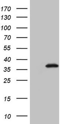 GEMIN2 Monoclonal Antibody (OTI4B3), TrueMAB , OriGene 100 &mu;L; Unconjugated:Antibodies,