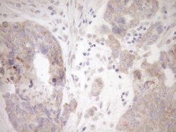 GEMIN8 Mouse anti-Human, Clone: OTI1E5, lyophilized, TrueMAB 100 &mu;g;