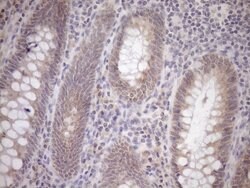GEMIN8 Mouse anti-Human, Clone: OTI1E5, lyophilized, TrueMAB 100 &mu;g;