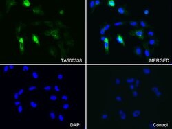 GFAP Mouse anti-Human, Clone: OTI4D11, lyophilized, TrueMAB 100 &mu;g;