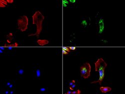GFAP Mouse anti-Human, Rat, Clone: UMAB5, lyophilized, UltraMAB 100 &mu;g | Buy Online | Origene Technologies | Fisher Scientific