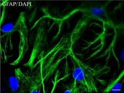 GFAP Mouse anti-Human, Rat, Clone: UMAB5, lyophilized, UltraMAB 100 &mu;g | Buy Online | Origene Technologies | Fisher Scientific