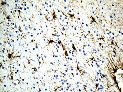 GFAP Mouse anti-Human, Clone: OTI1E11, lyophilized, TrueMAB 100 &mu;g;