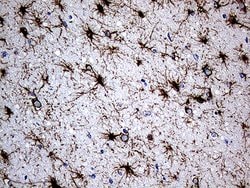 GFAP Mouse anti-Human, Clone: OTI1E11, lyophilized, TrueMAB 100 &mu;g;