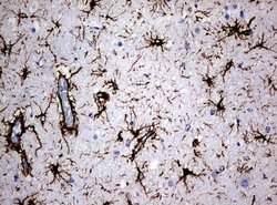 GFAP Mouse anti-Human, Rat, Clone: UMAB5, lyophilized, UltraMAB 100 &mu;g | Buy Online | Origene Technologies | Fisher Scientific