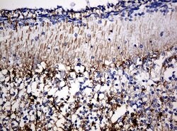 GFAP Mouse anti-Human, Rat, Clone: UMAB5, lyophilized, UltraMAB 100 &mu;g | Buy Online | Origene Technologies | Fisher Scientific