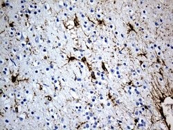 GFAP Mouse anti-Human, Rat, Clone: UMAB5, lyophilized, UltraMAB 100 &mu;g | Buy Online | Origene Technologies | Fisher Scientific