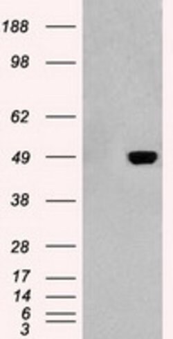 GFAP Mouse anti-Human, Clone: OTI4D11, lyophilized, TrueMAB 100 &mu;g;