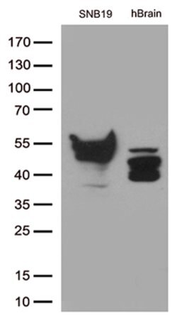 GFAP Mouse anti-Human, Clone: OTI4D11, lyophilized, TrueMAB 100 &mu;g;