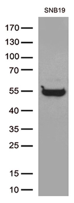GFAP Mouse anti-Human, Rat, Clone: OTI2D8, liquid, TrueMAB 100 &mu;L; Unconjugated:Antibodies,