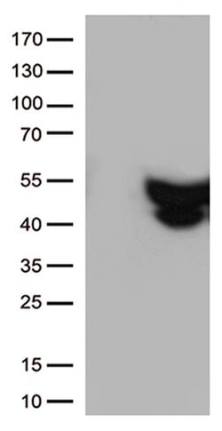 GFAP Mouse anti-Human, Clone: OTI2F7, liquid, TrueMAB 100 &mu;L; Unconjugated:Antibodies,