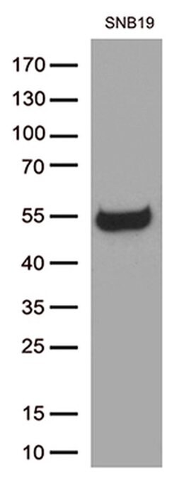 GFAP Mouse anti-Human, Clone: OTI2F7, liquid, TrueMAB 100 &mu;L; Unconjugated:Antibodies,
