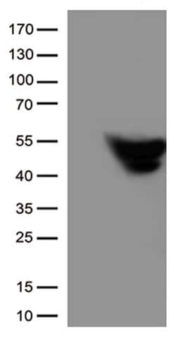 GFAP Mouse anti-Human, Rat, Clone: UMAB5, lyophilized, UltraMAB 100 &mu;g | Buy Online | Origene Technologies | Fisher Scientific