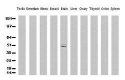 GFAP Mouse anti-Human, Rat, Clone: UMAB5, liquid, UltraMAB 30 &mu;L; Unconjugated:Antibodies,