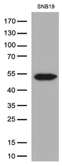 GFAP Mouse anti-Human, Rat, Clone: UMAB5, liquid, UltraMAB 30 &mu;L; Unconjugated:Antibodies,