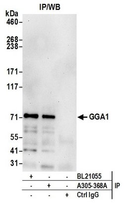 GGA1 Rabbit anti-Human, Polyclonal, Bethyl Laboratories 100 &mu;L; Unconjugated:Antibodies,