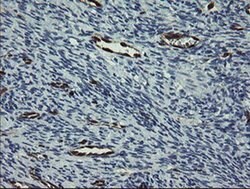 GIMAP4 Monoclonal Antibody (OTI1A11), TrueMAB , OriGene 100 &mu;L; Unconjugated:Antibodies,