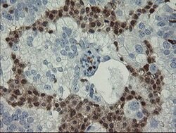 GIMAP4 Monoclonal Antibody (OTI1A11), TrueMAB , OriGene 100 &mu;L; Unconjugated:Antibodies,