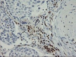 GIMAP4 Monoclonal Antibody (OTI1A11), TrueMAB , OriGene 100 &mu;L; Unconjugated:Antibodies,