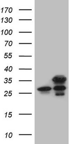GINS3 Mouse anti-Human, Clone: OTI3A12, lyophilized, TrueMAB 100 &mu;g;
