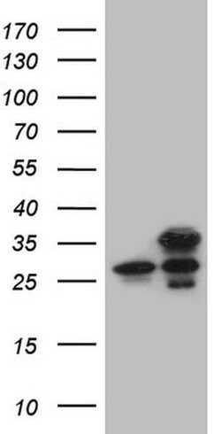 GINS3 Monoclonal Antibody (OTI3A12), TrueMAB , OriGene:Antibodies:Primary