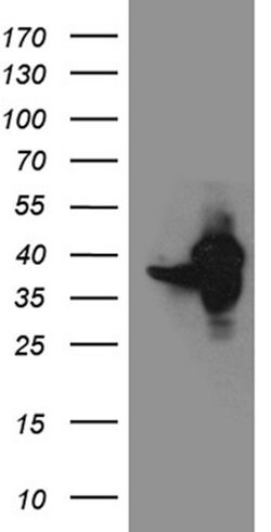 GIPC1 Monoclonal Antibody (OTI4C11), TrueMAB , OriGene 100 &mu;L; Unconjugated:Antibodies,
