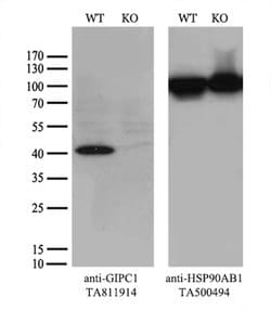 GIPC1 Monoclonal Antibody (OTI4C11), TrueMAB , OriGene 100 &mu;L; Unconjugated:Antibodies,
