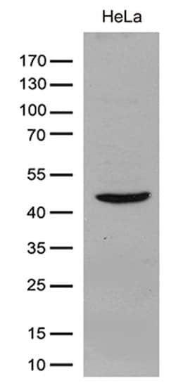 GIPC1 Monoclonal Antibody (OTI4C11), TrueMAB , OriGene 100 &mu;L; Unconjugated:Antibodies,