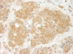 GIT1 Rabbit anti-Human, Polyclonal, Bethyl Laboratories 100 &mu;L; Unconjugated:Antibodies,