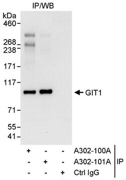 GIT1 Rabbit anti-Human, Polyclonal, Bethyl Laboratories 100 &mu;L; Unconjugated:Antibodies,