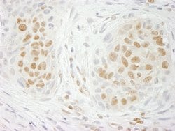 GIT2 Polyclonal Antibody, Bethyl Laboratories 100 &mu;L; Unconjugated:Antibodies,