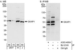 GKAP1 Rabbit anti-Human, Polyclonal, Bethyl Laboratories 100 &mu;l; Unlabeled:Antibodies,