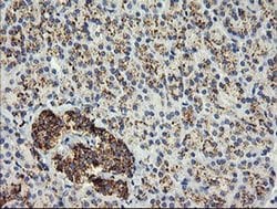 GLB1 Mouse anti-Human, Clone: OTI2F6, liquid, TrueMAB 100 &mu;L; Unconjugated:Antibodies,