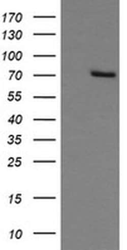 GLB1 Monoclonal Antibody (OTI10B2), TrueMAB , OriGene:Antibodies:Primary