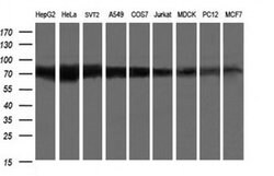 GLB1 Monoclonal Antibody (OTI10B2), TrueMAB , OriGene:Antibodies:Primary