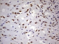 GLI1 Mouse anti-Human, Clone: OTI4C1, lyophilized, TrueMAB 100 &mu;g; Unconjugated:Antibodies,