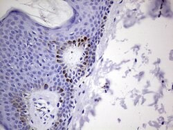 GLI1 Mouse anti-Human, Clone: OTI1C1, liquid, TrueMAB 100 &mu;L; Unconjugated:Antibodies,