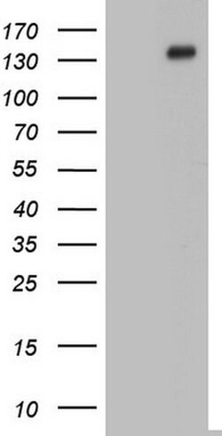 GLI1 Monoclonal Antibody (OTI1B4), TrueMAB , OriGene 30 &mu;L; Unconjugated:Antibodies,