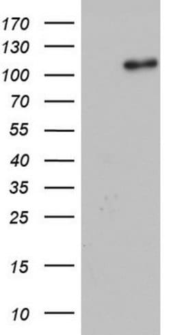 GLI1 Mouse anti-Human, Clone: OTI2B9, lyophilized, TrueMAB 100 &mu;g | Buy Online | Origene Technologies | Fisher Scientific
